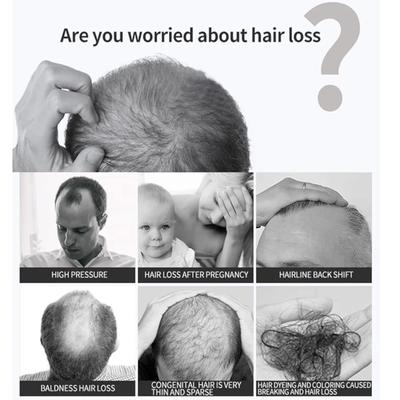 Anti-Hair Loss Hair